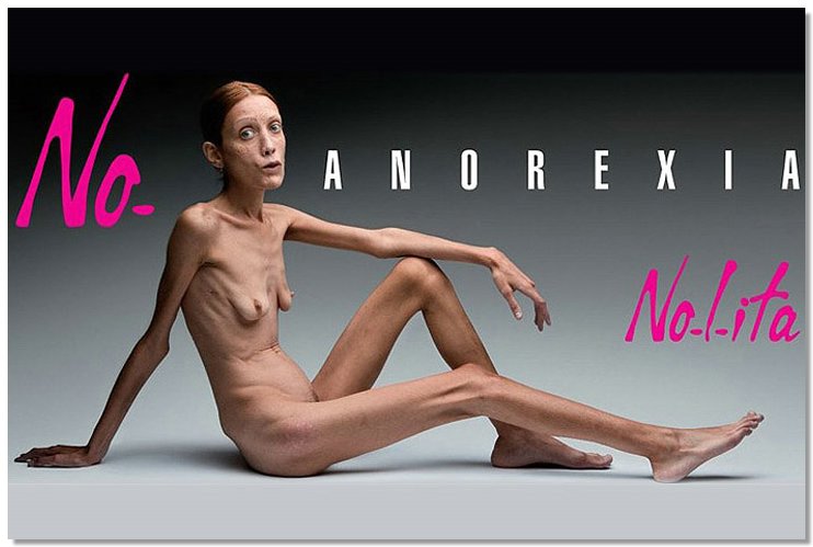 Anorexia06.jpg