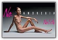 Anorexia06.jpg